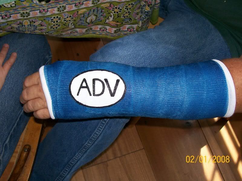 broken clutch hand Kawasaki KLR Forum