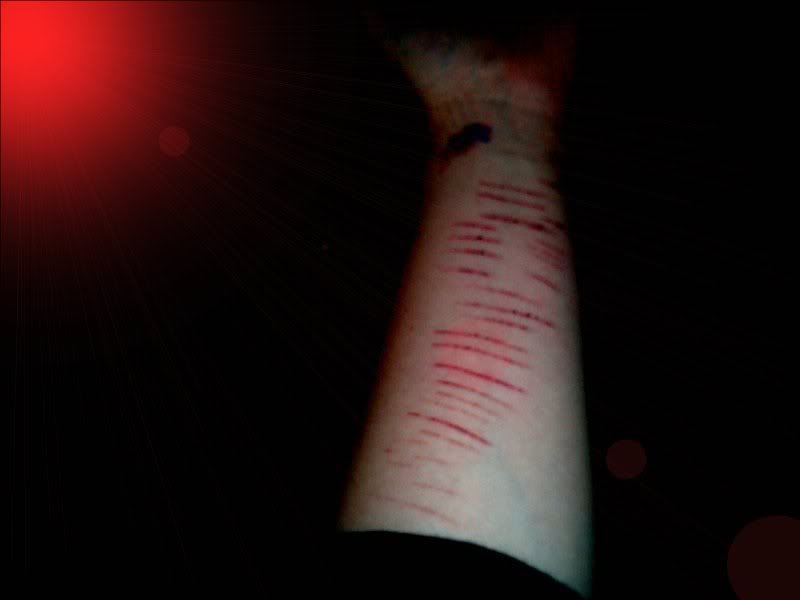 cut scars
